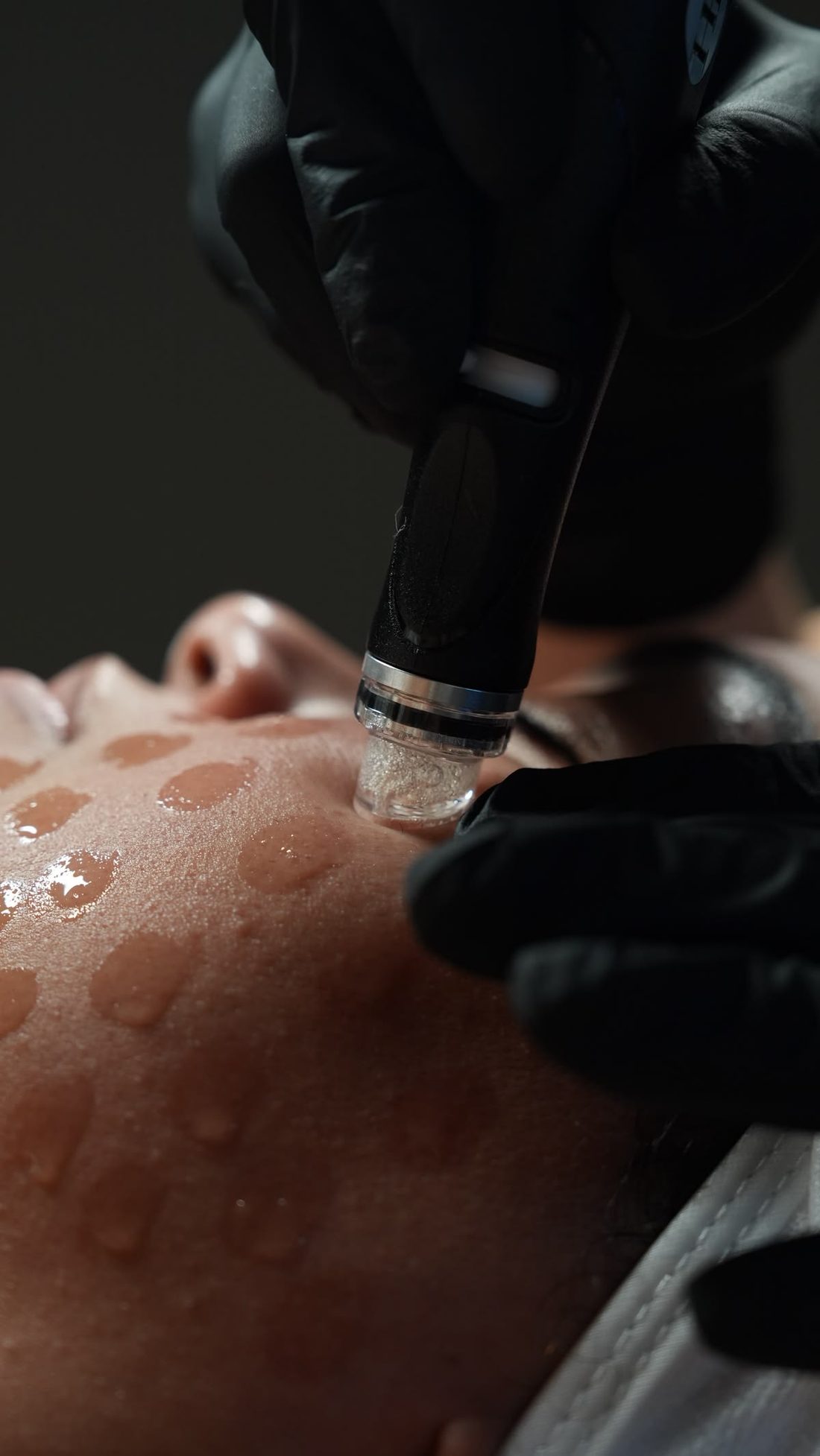 A close view of a HydraFacial wand gliding across freshly hydrated skin